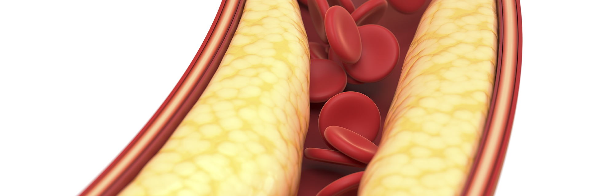 Controlar o colesterol - 8 Passos para a longevidade