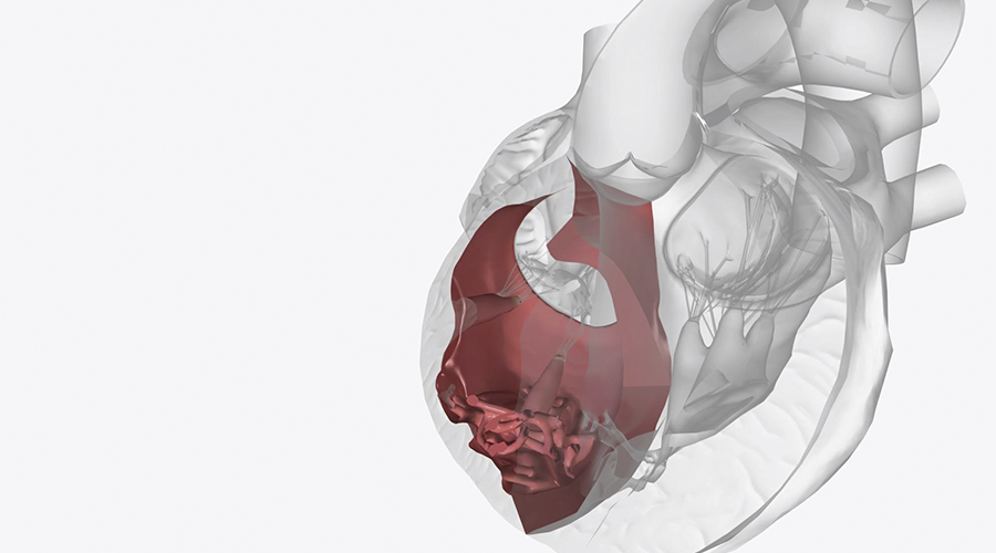Alterações Estruturais e Sintomas Clínicos