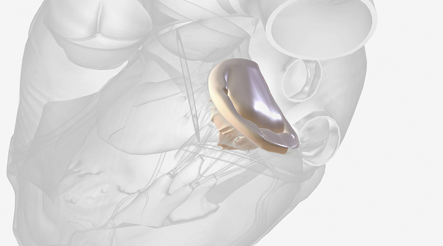 Como funciona o tratamento da válvula mitral