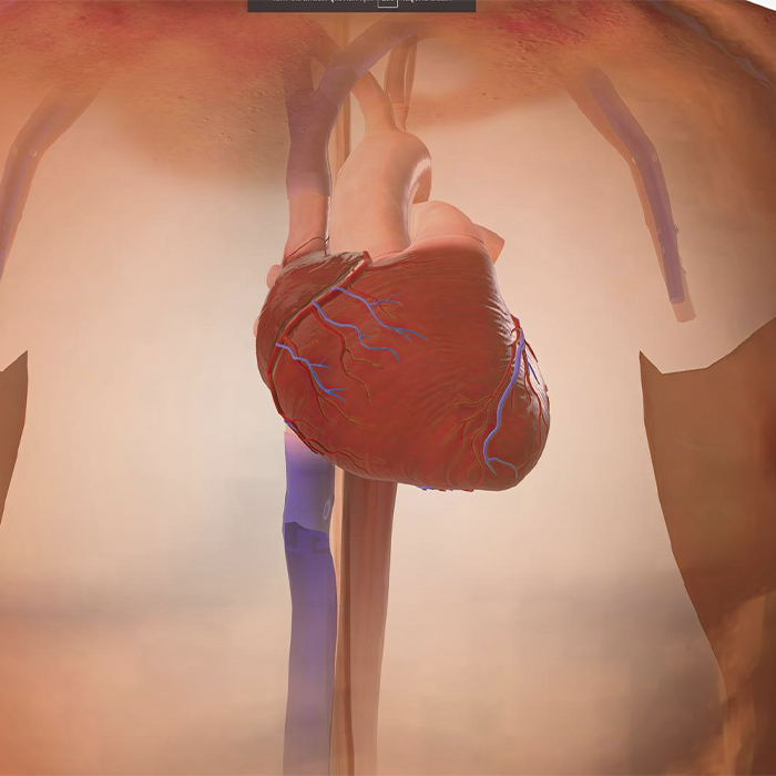 Doença de Chagas Cardíaca