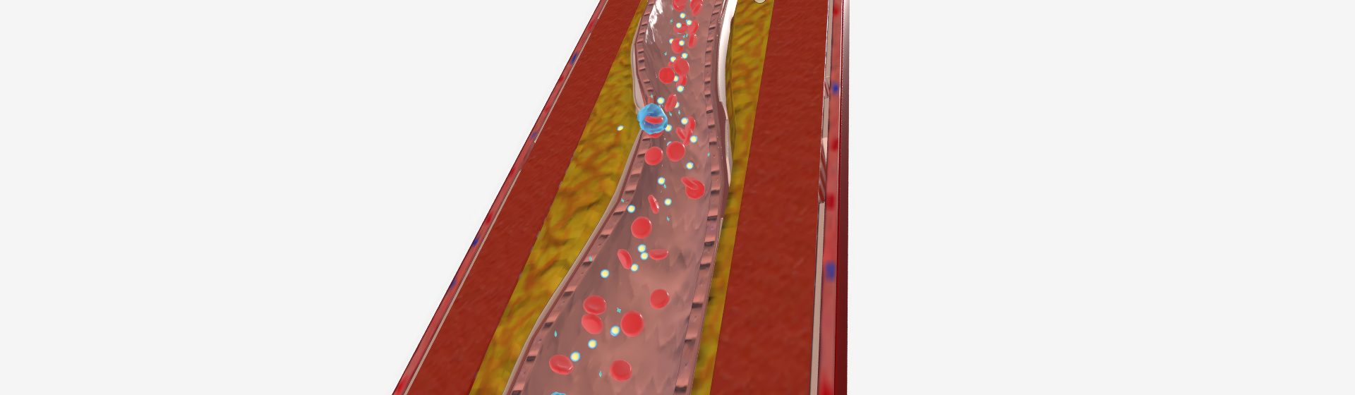 Hipercolesterolemia familiar