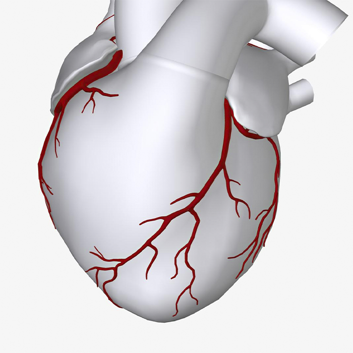 Hipertensão Arterial Sistemica