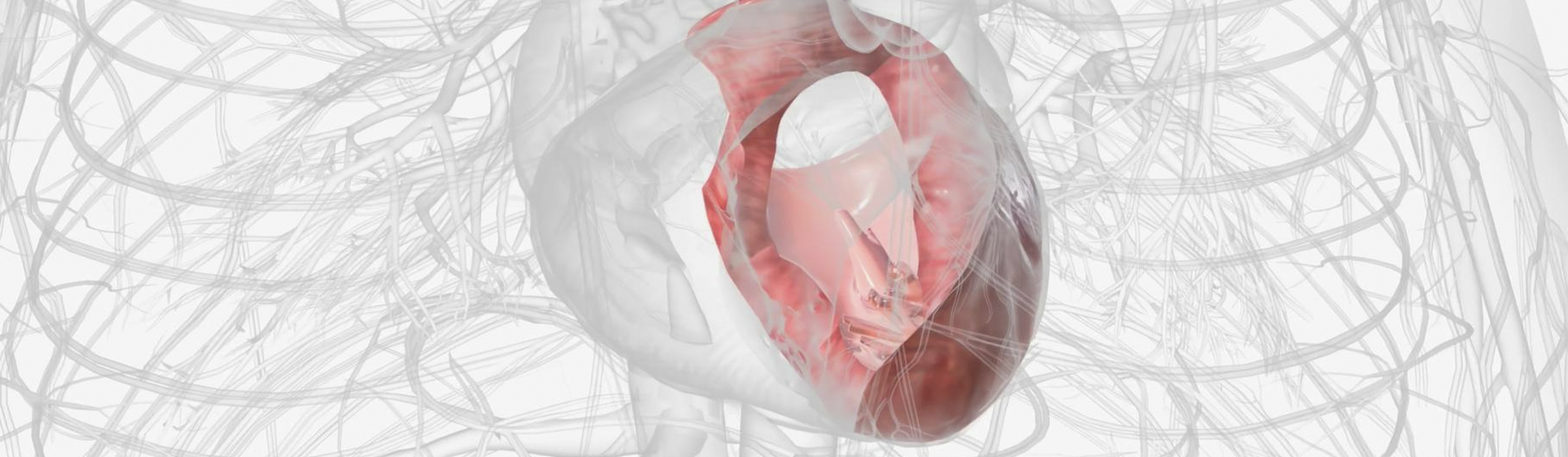 Insuficiencia cardicada hipertensiva