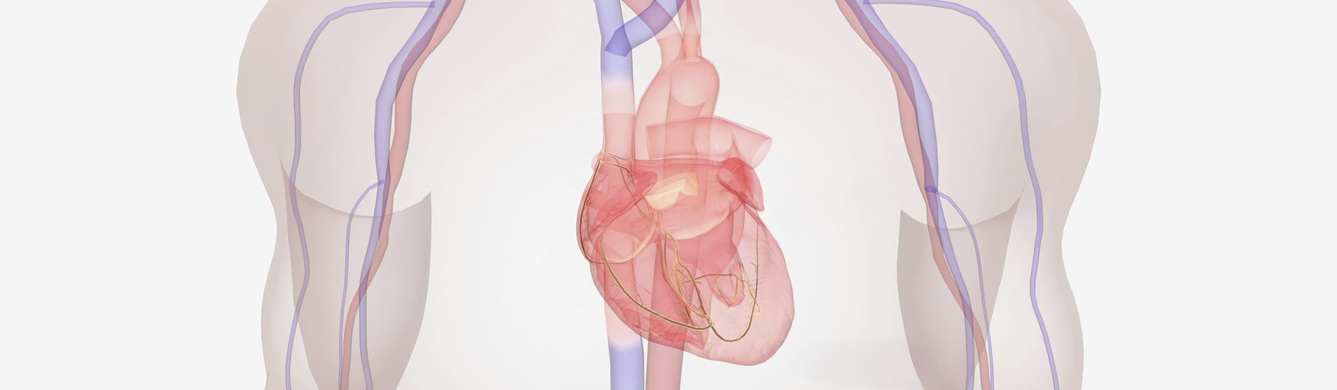 Miocardiopatia arritmogénica do ventrículo direito