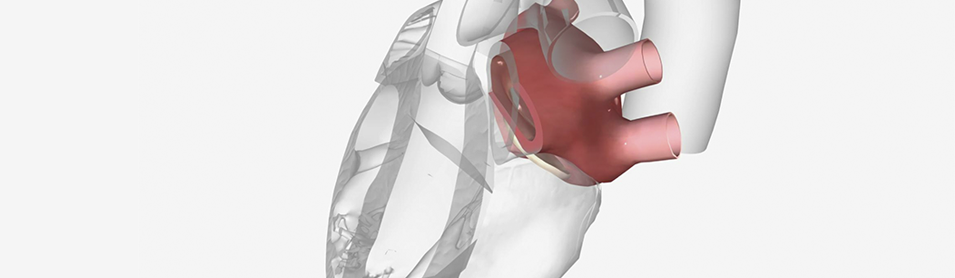 O prolapso da válvula mitral