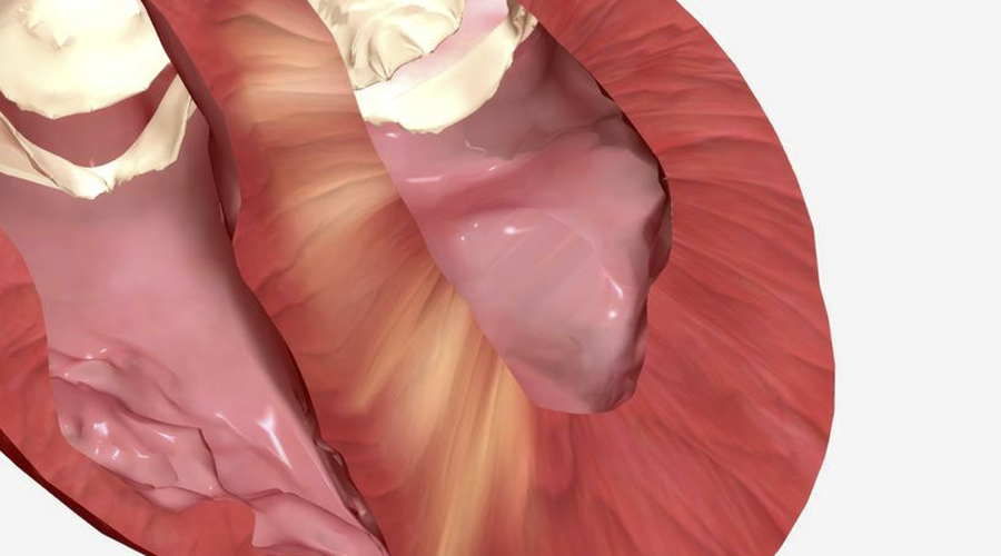 Por que esse espessamento acontece