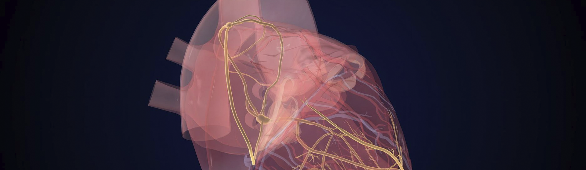 Síndrome do Nó Sinusal