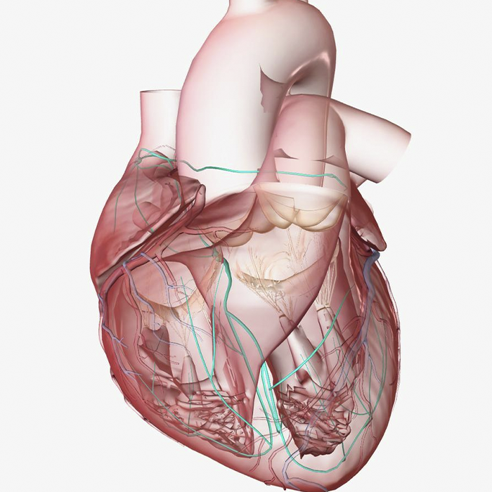 Taquicardia Ventricular